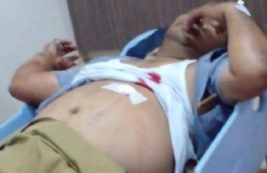 Satu Korban Meninggal, Pelaku Penembakan di Exit Tol Bintaro Ternyata Polisi Berpangkat Ipda