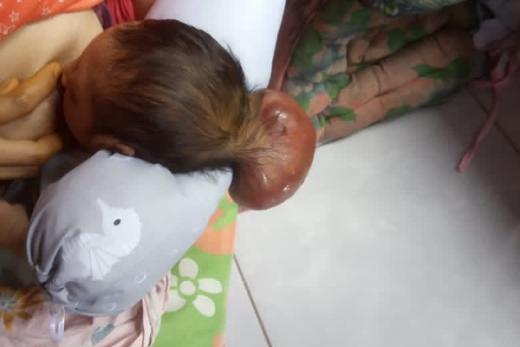 GoNews.co Anak Sunarti, warga tak mampu