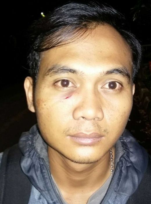 Bukan Hanya Dipukuli, Wartawan TV Ini Juga Diancam Ditembak dan Diborgol Oknum Polisi