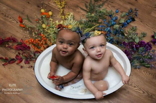 Wanita Berkulit Putih Lahirkan Bayi Kembar dengan Warna Kulit Berbeda, Kok Bisa?