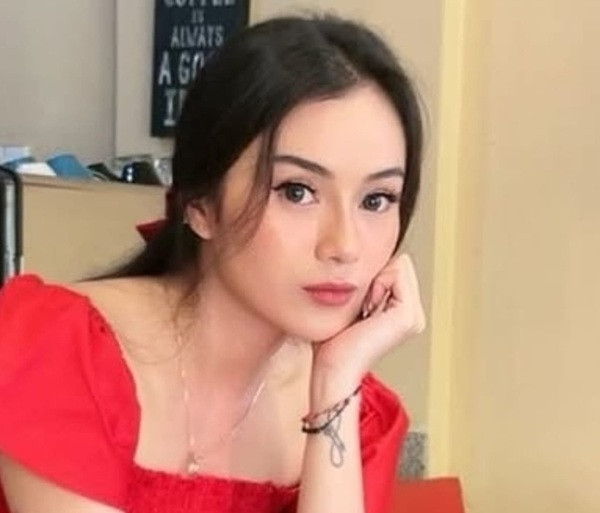 Dara The Virgin Belum Bisa Tampil Maksimal di Panggung Usai Operasi Tumor Payudara