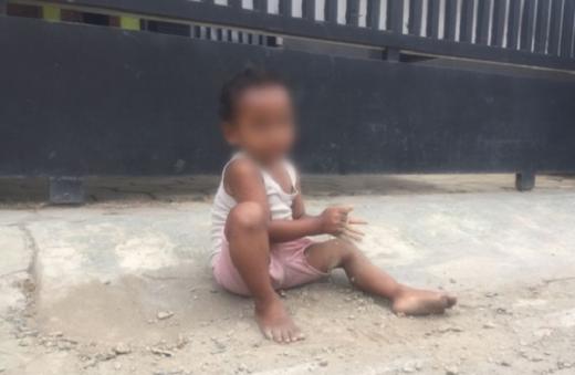 Jarang Jajan karena Ayahnya Tak Mampu, Balita di Tegal Hobi Makan Pecahan Tembok