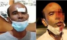 Terbongkar, Eks Anggota DPRD yang Ngaku Matanya Ditusuk Petugas PPKM, Ternyata Cuma Pelipisnya yang Kena