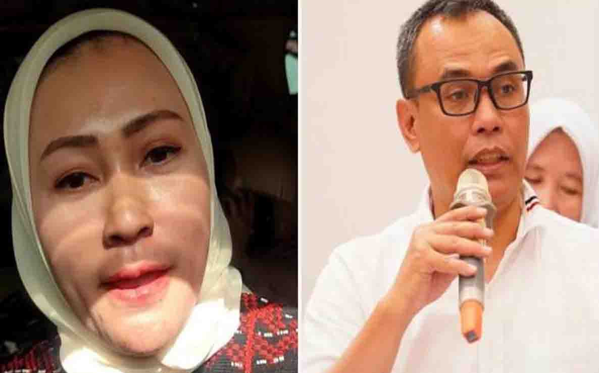 Sesama Kader Golkar Berseteru, Komentar di Instagram Berujung Laporan Polisi