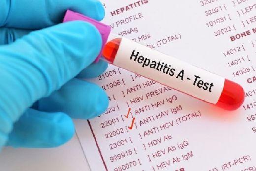 Puluhan Siswa dan Guru di Depok Diduga Terjangkit Hepatitis A