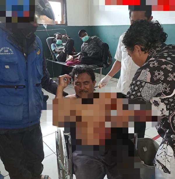 Aksi Brutal OTK di Puncak Jaya, Korban Luka Parah Akibat Kekerasan Menggunakan Senjata Tajam